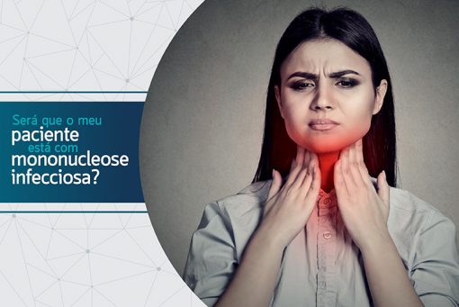 Será que o meu paciente está com mononucleose infecciosa