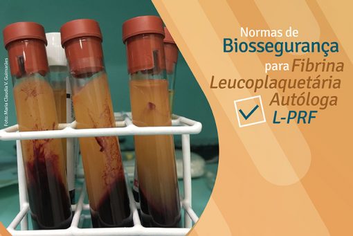 Fibrina Leucoplaquetária Autóloga L-PRF em Odontologia