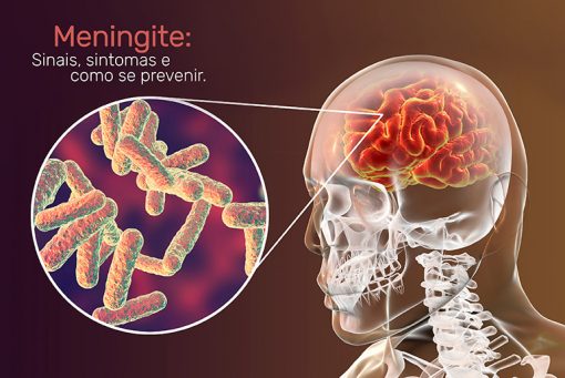 Meningite - Sinais, sintomas e como se prevenir